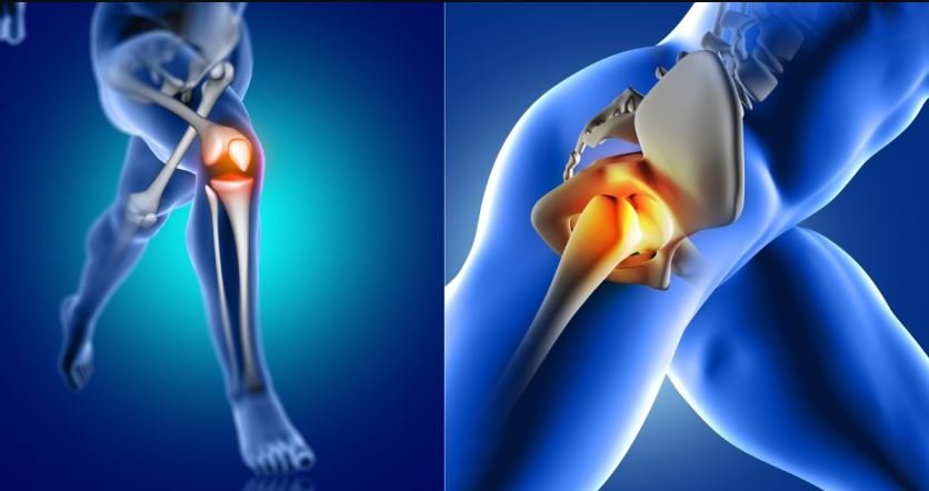 The Importance of Post-Operative Rehabilitation After Knee and Hip Replacement Surgery