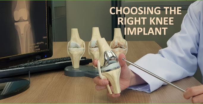 Total knee replacement (TKR): the path to pain-free movement. By Dr. Vivek Logani