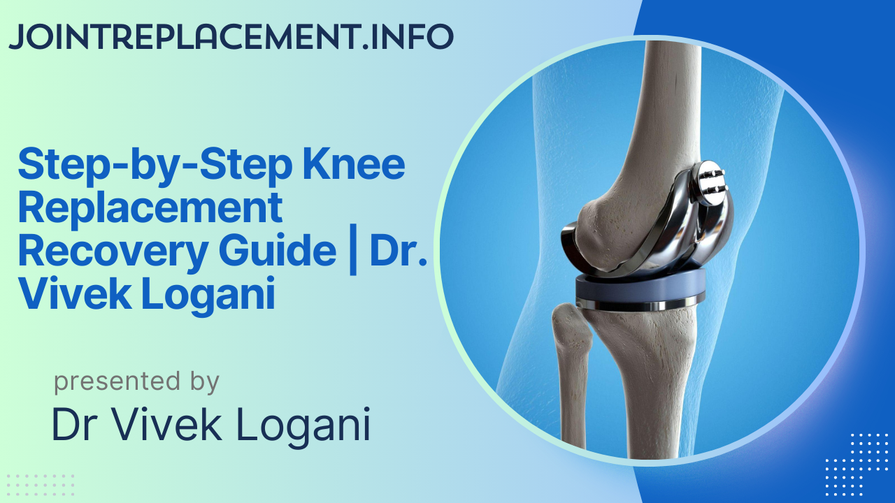 Step-by-Step Knee Replacement Recovery Guide |