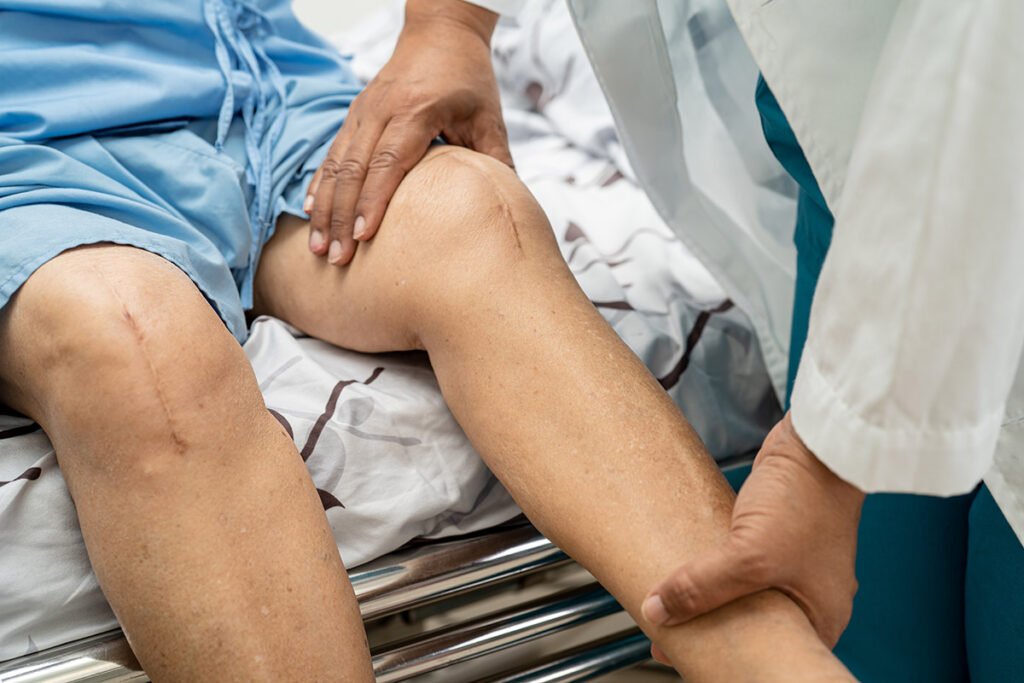 young adults knee surgery in Gurgaon