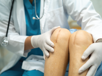 young adults knee surgery in Gurgaon