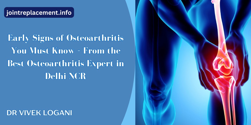 Best Osteoarthritis Expert in Delhi NCR