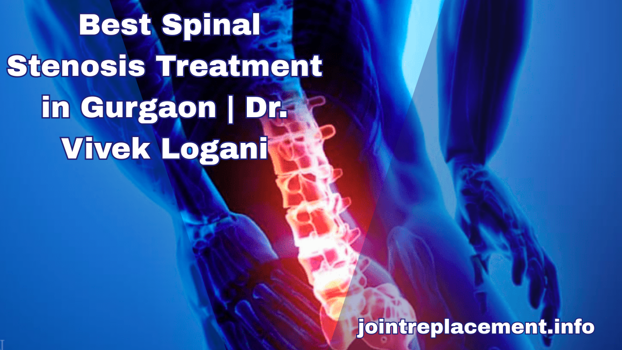 Spinal Stenosis: Causes, Symptoms, and Treatment Options