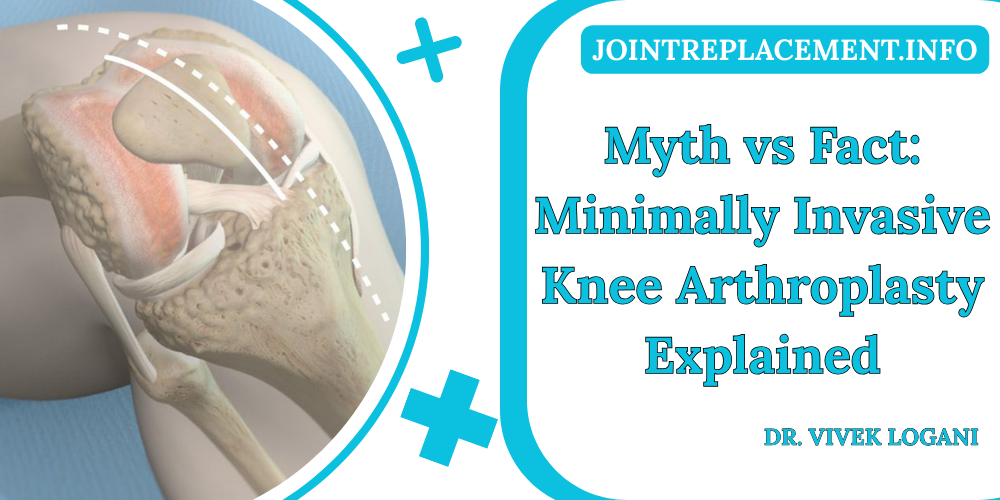 Myth vs Fact: Minimally Invasive Knee Arthroplasty Explained